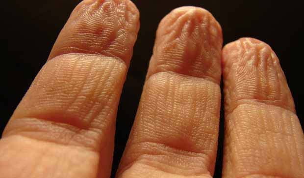 fingers prune