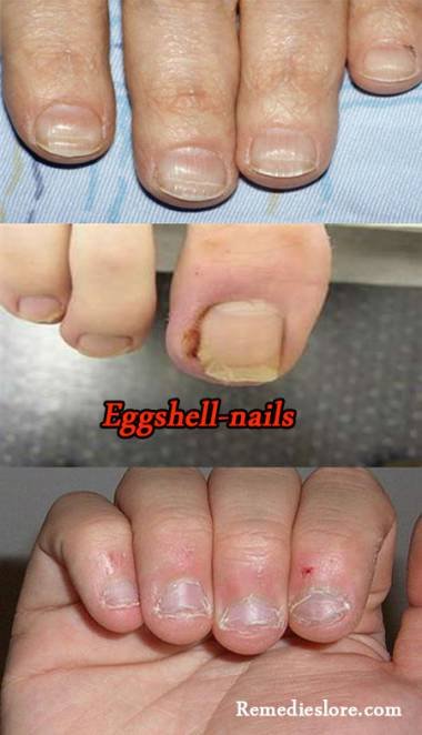 egg_shell_nails