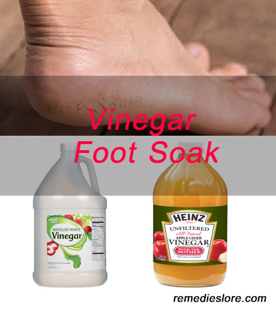 vinegar-foot-soak