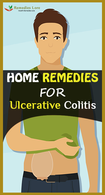 Home Remedies for Ulcerative Colitis