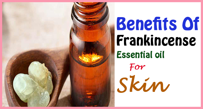 Benefits Of Frankincense Essential Oil For Skin Remedies Lore 6374