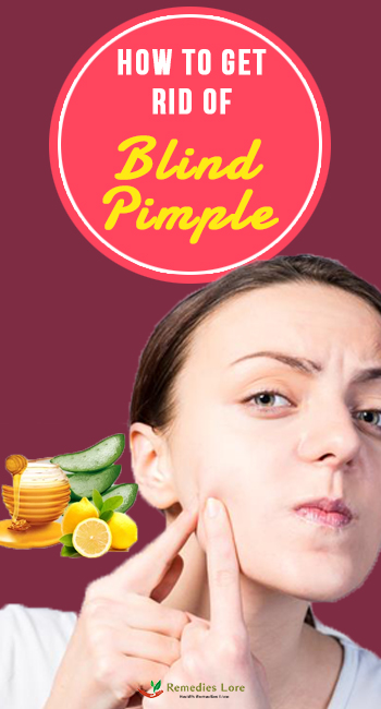 warm compress for blind pimple