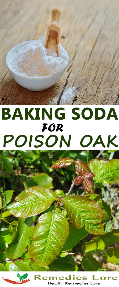 How to Use Baking Soda for Poison Oak - 4 DIY Remedies - Remedies Lore