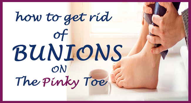 how-to-get-rid-of-bunions-on-the-pinky-toe-remedies-lore