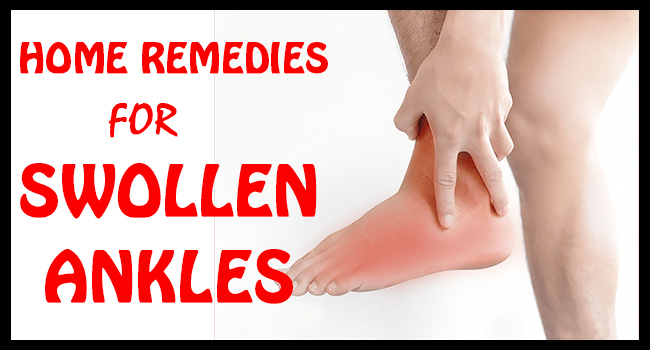 swelling in legs home remedies