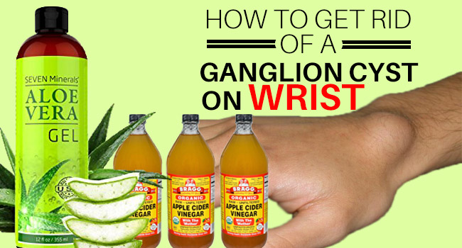 5 Home Remedies To Get Rid Of Ganglion Cysts Youtube Reverasite