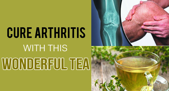 Cure Arthritis With This Wonderful Tea - Remedies Lore