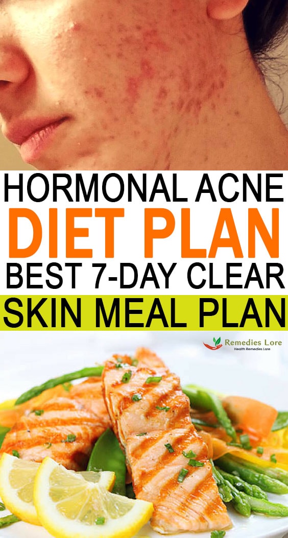 Hormonal Acne Diet Plan best 7 day Clear Skin Meal Plan Vixohealth